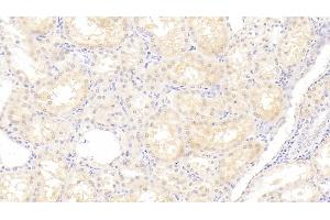 Detection of ANG in Human Kidney Tissue using Polyclonal Antibody to Angiogenin (ANG) (ANG antibody  (AA 25-147))