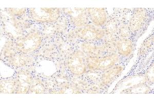 Detection of ANG in Human Kidney Tissue using Polyclonal Antibody to Angiogenin (ANG)