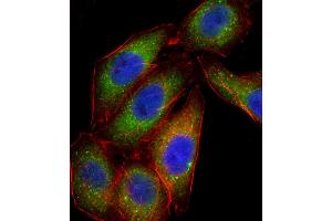 Fluorescent confocal ige of A549 cell stained with PK14 Antibody (Center /) (ABIN656420 and ABIN2845711). (MAPK14 antibody  (AA 158-192))