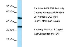 Western Blotting (WB) image for anti-Calsequestrin 2 (CASQ2) (N-Term) antibody (ABIN2789644) (CASQ2 antibody  (N-Term))