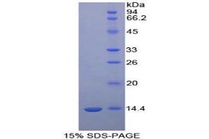 SDS-PAGE analysis of Cow Melatonin Receptor 1A Protein. (Melatonin Receptor 1A Protein (MTNR1A))