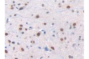 DAB staining on IHC-P; Samples: Rat Spinal cord Tissue (Renin antibody  (AA 275-389))