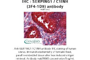 Image no. 2 for anti-Serpin Peptidase Inhibitor, Clade G (C1 Inhibitor), Member 1 (SERPING1) (AA 1-501), (full length) antibody (ABIN1723814) (SERPING1 antibody  (full length))