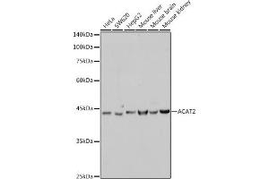 Western blot analysis of extracts of various cell lines, using  antibody (ABIN7265364) at 1:1000 dilution. (ACAT2 antibody)