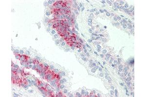 Anti-PAK4 antibody IHC staining of human prostate. (PAK4 antibody  (AA 187-216))