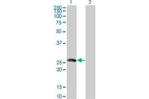 Western Blot analysis of BTG4 expression in transfected 293T cell line by BTG4 monoclonal antibody (M07), clone 1A6. (BTG4 antibody  (AA 1-206))
