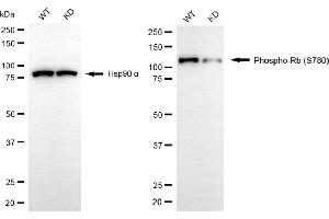 Western blotting analysis using phospho-Rb (S780) antibody (ABIN7800187). (Recombinant Retinoblastoma Protein (Rb) antibody  (pSer780))
