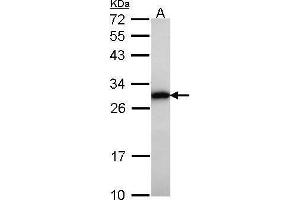 WB Image Sample (30 ug of whole cell lysate) A: Raji 12% SDS PAGE GRB2 antibody antibody diluted at 1:1000 (GRB2 antibody  (C-Term))