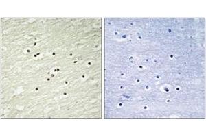 Immunohistochemistry analysis of paraffin-embedded human brain tissue, using Cyclin H (Ab-315) Antibody. (Cyclin H antibody  (AA 274-323))