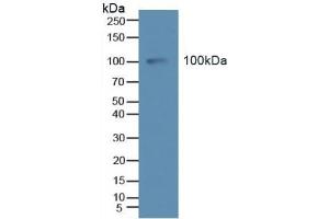 Detection of Tie2 in Human Serum using Polyclonal Antibody to TEK Tyrosine Kinase, Endothelial (Tie2) (TEK antibody  (AA 286-465))
