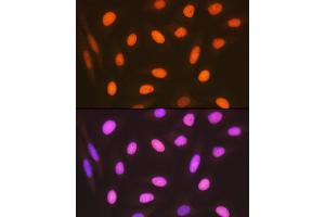Immunofluorescence analysis of U-2 OS cells using HMGB2 Rabbit mAb (ABIN7267649) at dilution of 1:100 (40x lens). (HMGB2 antibody)
