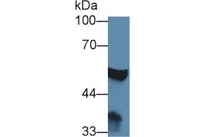 Detection of ABAT in Rat Cerebrum lysate using Polyclonal Antibody to 4-Aminobutyrate Aminotransferase (ABAT) (ABAT antibody  (AA 236-500))