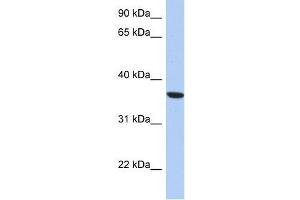 PSTK antibody used at 1 ug/ml to detect target protein. (PSTK antibody  (Middle Region))