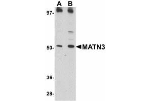 Image no. 1 for anti-Matrilin 3 (MATN3) (C-Term) antibody (ABIN478072) (Matrilin 3 antibody  (C-Term))