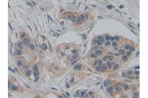 Immunohistochemistry (IHC) image for anti-SMAD, Mothers Against DPP Homolog 5 (SMAD5) (AA 210-464) antibody (ABIN7441760)