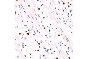 Immunohistochemistry of paraffin-embedded human appendicitis using GEMIN2 antibody at dilution of 1:200 (400x lens). (SIP1 antibody)