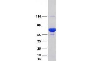 PRKAR1B Protein (Transcript Variant 4) (Myc-DYKDDDDK Tag)