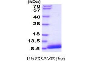 SDS-PAGE (SDS) image for Epidermal Growth Factor (EGF) (AA 977-1029) (Active) protein (His tag) (ABIN5855074) (EGF Protein (AA 977-1029) (His tag))