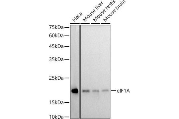 Eukaryotic Translation Initiation Factor 1A (EIF1A) antibody