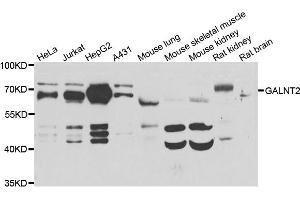 Western blot analysis of extracts of various cell lines, using GALNT2 antibody (ABIN5974158) at 1/1000 dilution. (GALNT2 antibody)
