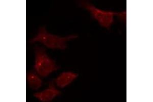 ABIN6275055 staining HepG2 by IF/ICC. (DHRS4 antibody  (C-Term))