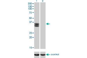 Western blot analysis of SIX2 over-expressed 293 cell line, cotransfected with SIX2 Validated Chimera RNAi (Lane 2) or non-transfected control (Lane 1). (SIX2 antibody  (AA 1-291))