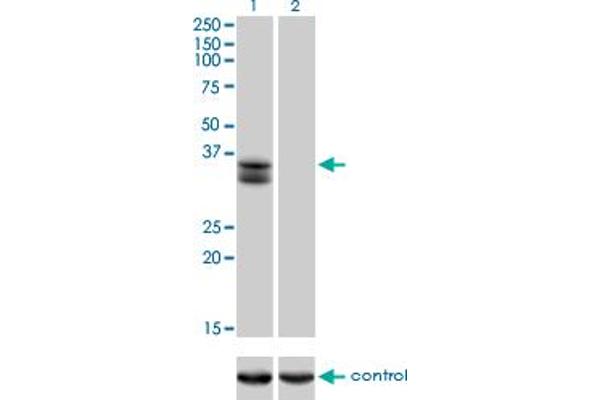 SIX2 Antikörper  (AA 1-291)