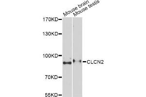 Western blot analysis of extracts of various cell lines, using CLCN2 Antibody.
