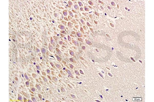 PERK antibody  (pThr980)