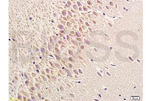 Formalin-fixed and paraffin embedded rat brain labeled with Anti-Phospho-PERK(Thr980) Polyclonal Antibody, Unconjugated (ABIN744713) at 1:200 followed by conjugation to the secondary antibody and DAB staining (PERK antibody  (pThr980))