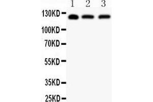 Anti-SIRT1 Picoband antibody,  All lanes: Anti SIRT1  at 0. (SIRT1 antibody  (AA 112-311))