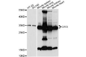 Western blot analysis of extracts of various cell lines, using CA13 antibody (ABIN6292753) at 1:3000 dilution. (CA13 antibody)
