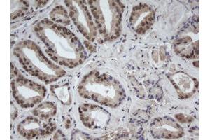 Image no. 1 for anti-Cullin 4B (CUL4B) (AA 1-300) antibody (ABIN1490724) (Cullin 4B antibody  (AA 1-300))