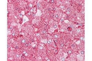 Anti-MINK1 / MAP4K6 antibody IHC of human liver. (MAP4K6 antibody  (Internal Region))
