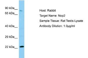 WB Suggested Anti-Nop2 Antibody   Titration: 1. (Nucleolar Protein 1 (NOL1) (N-Term) antibody)