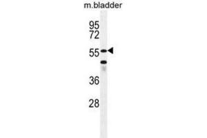 Western Blotting (WB) image for anti-SHQ1 Homolog (SHQ1) antibody (ABIN2996338) (SHQ1 antibody)