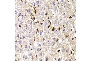 Immunohistochemistry of paraffin-embedded Human liver injury using SPN antibody at dilution of 1:100 (x400 lens).