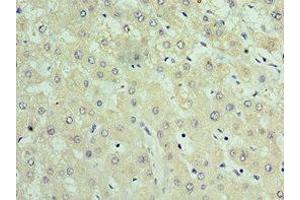 Immunohistochemistry of paraffin-embedded human liver tissue using ABIN7159904 at dilution of 1:100 (TIMM21 antibody  (AA 1-248))
