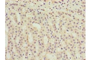 Immunohistochemistry of paraffin-embedded human adrenal gland tissue using ABIN7173199 at dilution of 1:100 (TMEM31 antibody  (AA 1-118))