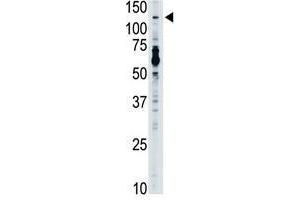 Image no. 1 for anti-Toll-Like Receptor 7 (TLR7) (N-Term) antibody (ABIN357057) (TLR7 antibody  (N-Term))