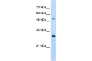 Western Blotting (WB) image for anti-PSME3 (PSME3) antibody (ABIN2462949) (PSME3 antibody)