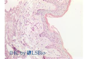 ABIN1019658 (5µg/ml) staining of paraffin embedded Human Skin. (SOX9b antibody  (AA 248-259))