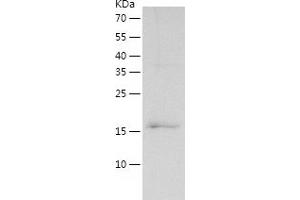 Western Blotting (WB) image for Cardiac Troponin C (TNNC1) (AA 1-161) protein (His tag) (ABIN7286775) (TNNC1 Protein (AA 1-161) (His tag))