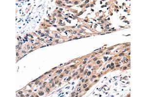 Immunohistochemistry (IHC) image for anti-Gap Junction Protein, beta 2, 26kDa (GJB2) antibody (ABIN2425961) (GJB2 antibody)