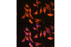 Immunofluorescence analysis of HeLa cells using α-Actin-1  Rabbit mAb (ABIN3015986, ABIN3015987, ABIN1680683 and ABIN1680684) at dilution of 1:100 (40x lens). (Actin antibody)