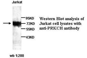 Image no. 1 for anti-Protein Kinase C, eta (PRKCH) antibody (ABIN790881) (PKC eta antibody)