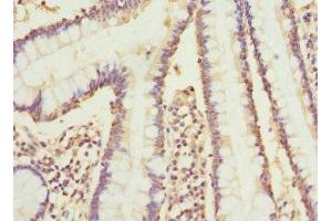 Immunohistochemistry of paraffin-embedded human small intestine tissue using ABIN7149242 at dilution of 1:100 (CYP2C18 antibody  (AA 231-490))