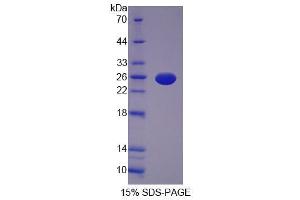 Image no. 1 for Interleukin 12 alpha (IL12A) (AA 26-215) protein (His tag) (ABIN6236554)