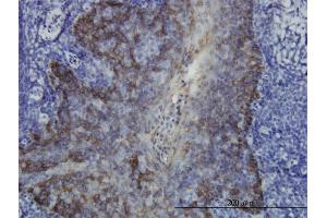 Immunoperoxidase of monoclonal antibody to KRT17 on formalin-fixed paraffin-embedded human tonsil. (KRT17 antibody  (AA 1-432))