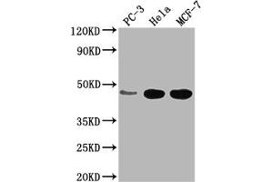 Western Blot Positive WB detected in: PC-3 whole cell lysate, Hela whole cell lysate, MCF-7 whole cell lysate All lanes: CCDC74B antibody at 1:2000 Secondary Goat polyclonal to rabbit IgG at 1/50000 dilution Predicted band size: 42, 36 kDa Observed band size: 42 kDa (CCDC74B antibody  (AA 1-257))